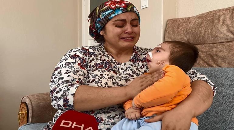 Nadir görülen Goldenhar Sendromu ile dünyaya gelen Asım bebek, ameliyat olmayı bekliyor