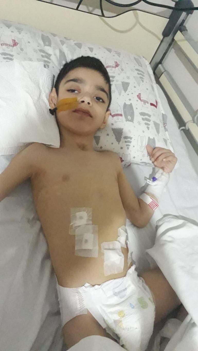 Doktorların yaşamaz dediği Ayaz konuşmaya başladı