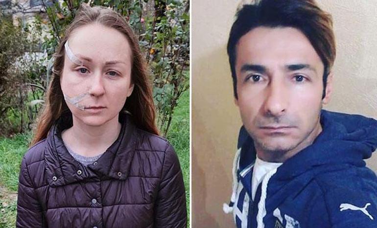 Ukraynalı eşinin yüzünü falçatayla kesti; 11 yıl hapis cezası istinaftan döndü