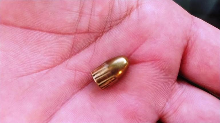 Evinin bahçesinde otururken yorgun mermi ile yaralandı