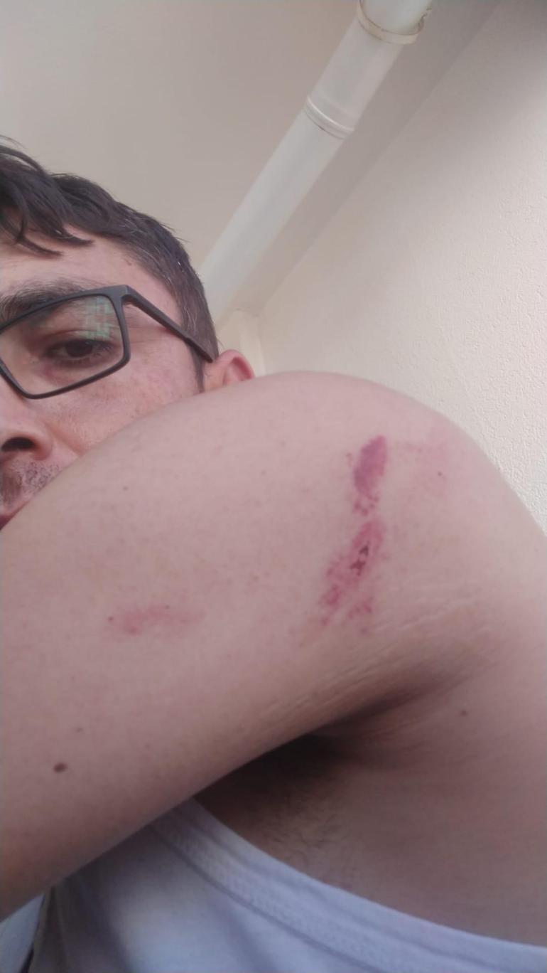 Apartmanda komşuların yumruklu kavgası kamerada