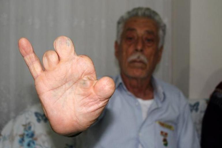 Kıbrıs gazisi ve eşine darp iddiası