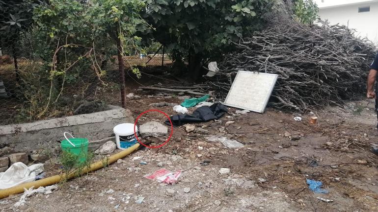 Kapağı kırık foseptiğe düşen 4 yaşındaki Naz Gül öldü