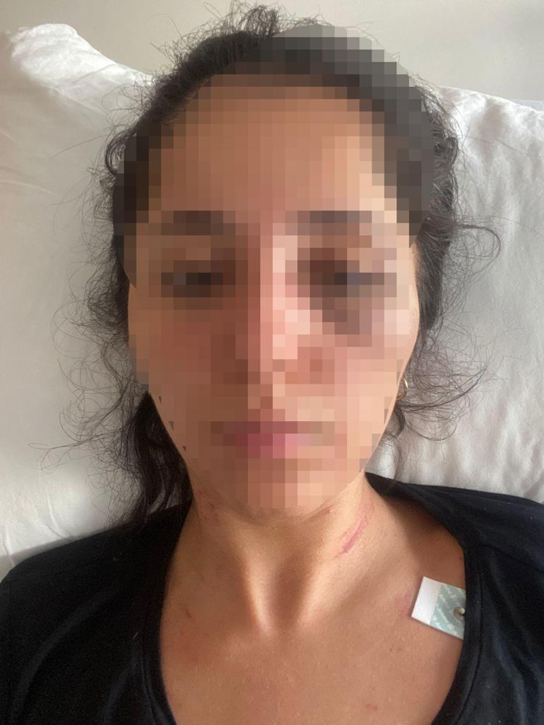 Sevgilisini dövüp 5 yerinden bıçaklayan doktora 20 yıl hapis istemi