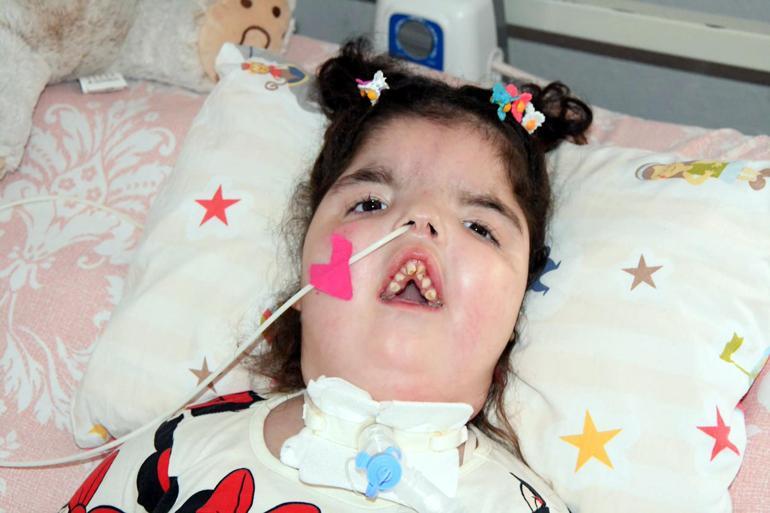 4 cihaza bağlı yaşayan SMAlı Yarenin babası: 1 lira bile umudumuz