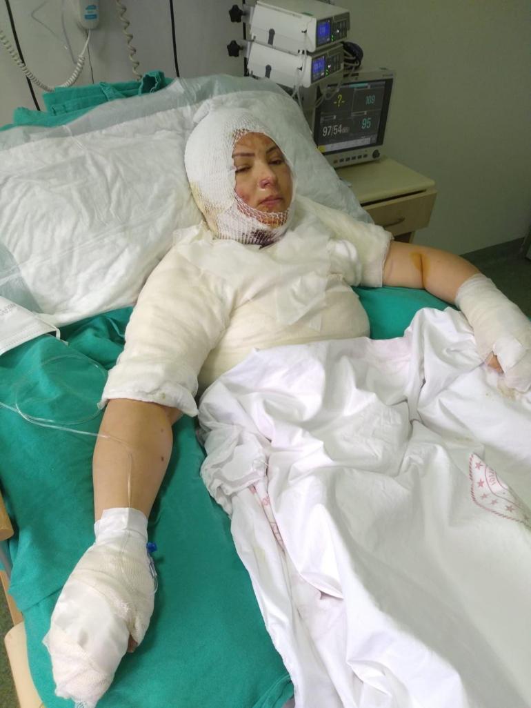 Eski eşini yakan sanığa 20 yıl hapis istemi