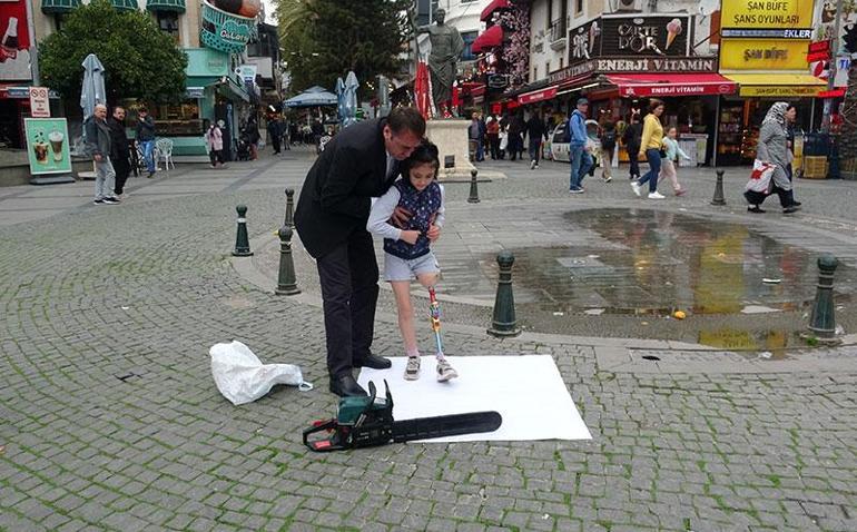 Kızı Özgenin kesilen bacağı için motorlu testereyle eylem yaptı