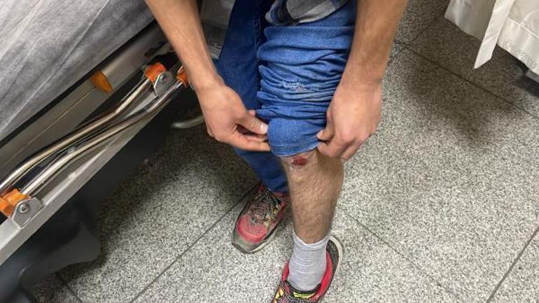 Otobüs beklerken köpeklerin saldırısına uğrayan üniversiteli yaralandı