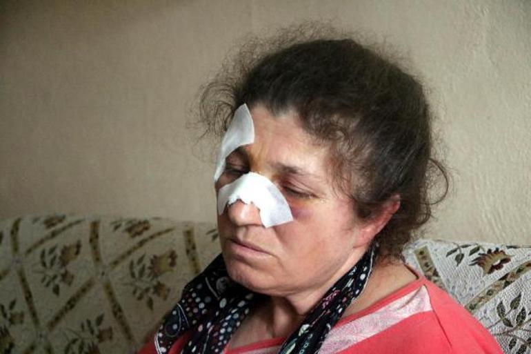 Husumetli olduğu akrabası baba-oğulun baltalı saldırısında yaralandı