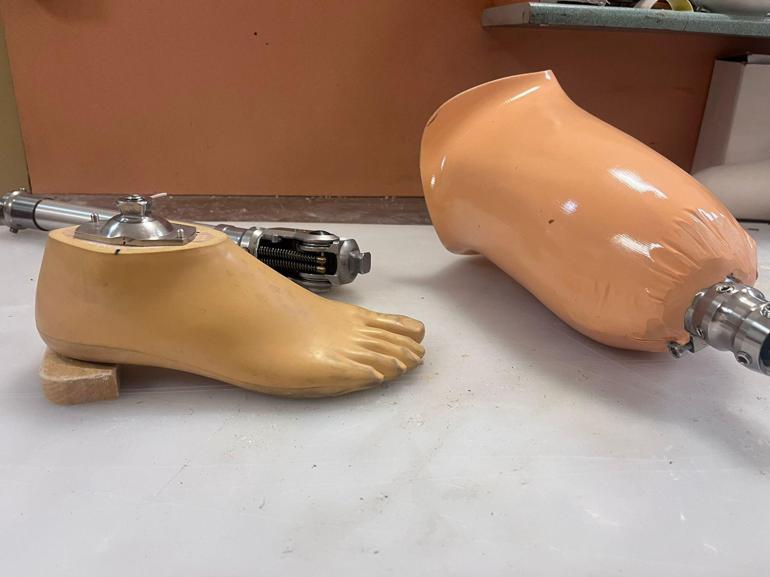 Kol ve bacağını kaybeden depremzedeler, Hacettepede hayata tutunuyor