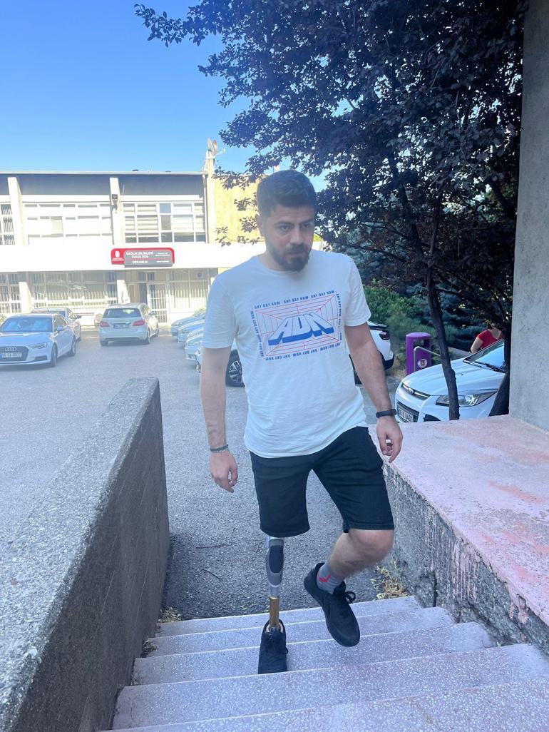 Kol ve bacağını kaybeden depremzedeler, Hacettepede hayata tutunuyor