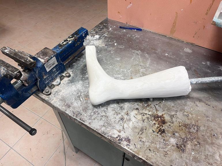 Kol ve bacağını kaybeden depremzedeler, Hacettepede hayata tutunuyor