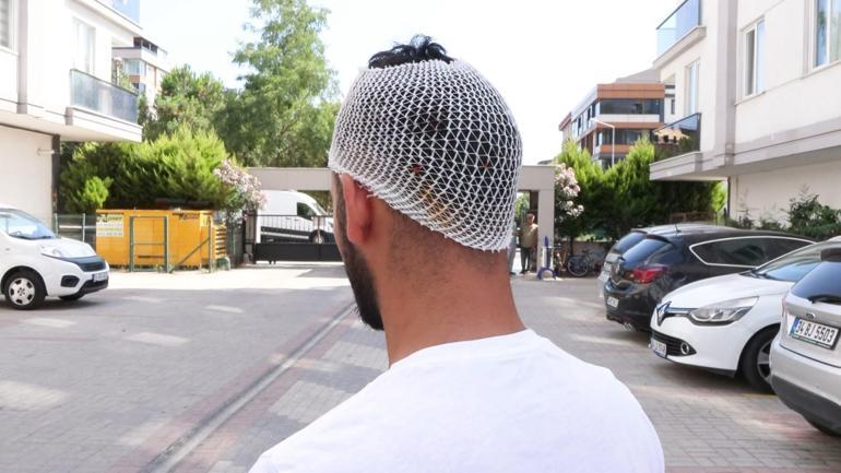 Bahçelievlerde alev alınca balkondan atılan tüp sürücünün kafasına düştü