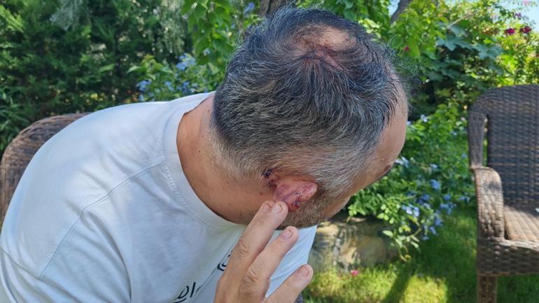 Restoran sahibine dambıl barı ile saldırı; çalışanları 100 bin lirasını gasbetti