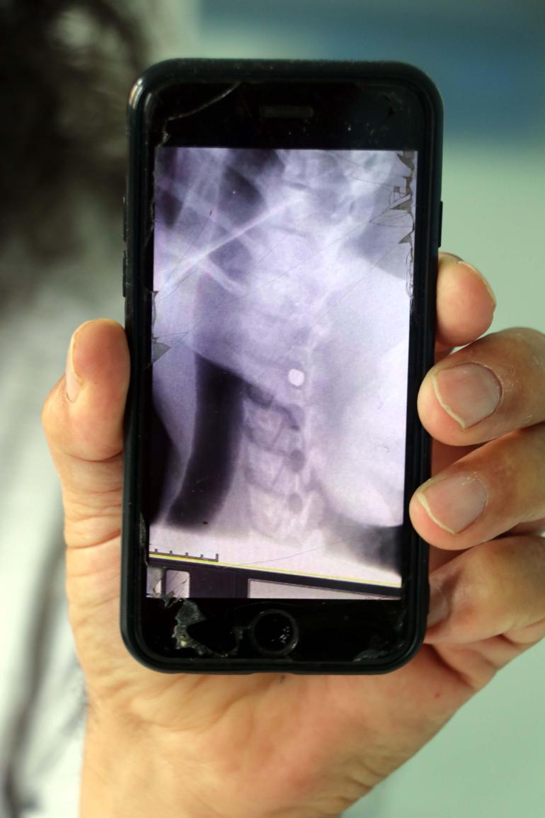 Hakkaride bulunan ayı düşen kaya parçalarıyla değil, ateşli silahla yaralanmış