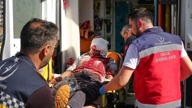 Elektrikli testere yüzünü kesti; gözünü kaybetme riski var