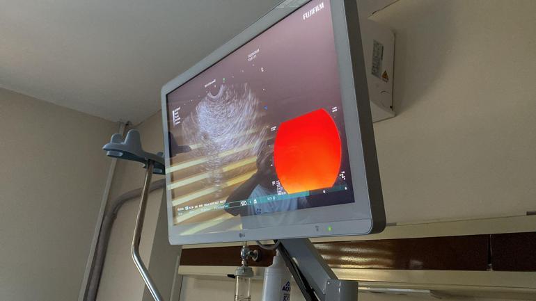 Rizede endoskopik ultrasonografi cihazı eğitimi verilirken hastalara da teşhis koyuldu