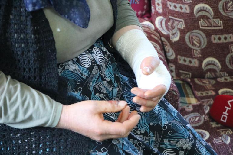 Köyde hayvanları otlatma kavgasında darbedildi