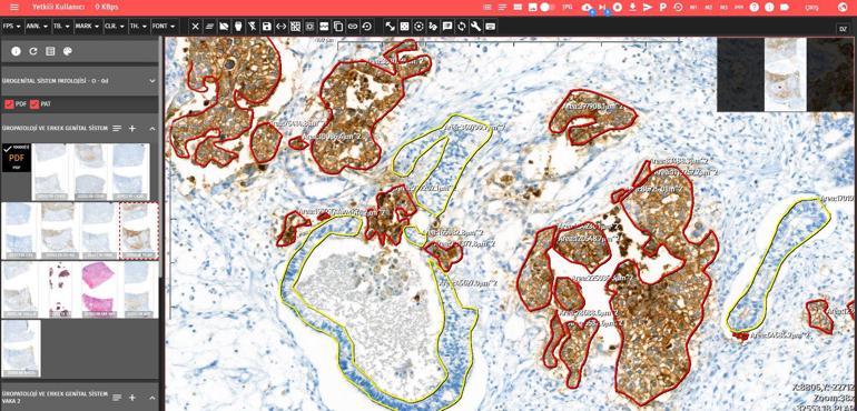 Ankara Üniversitesinden yerli ve milli patoloji yazılım programı