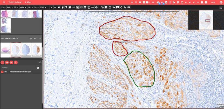Ankara Üniversitesinden yerli ve milli patoloji yazılım programı