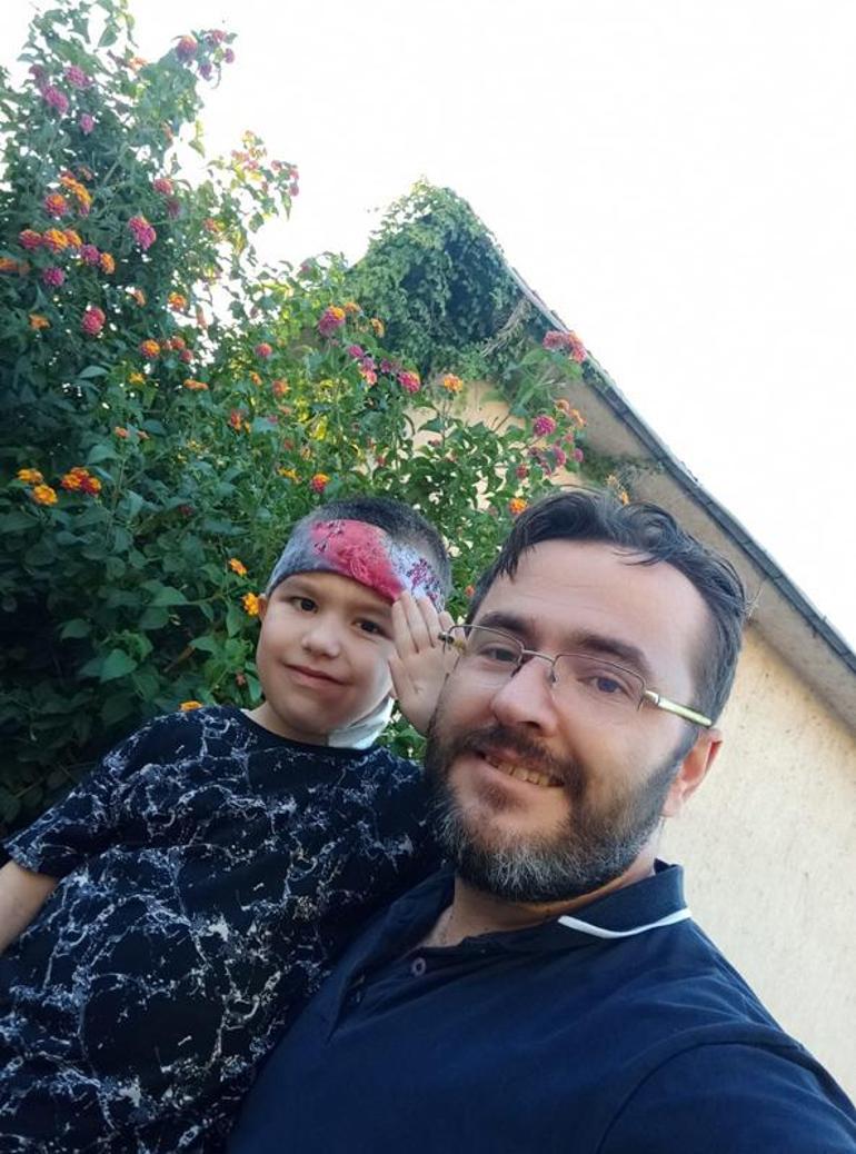 Oğluna böbreğini bağışlayan baba: O benim parçamdı, bir parçam daha ona geçti