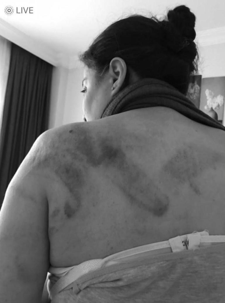 Bağcılarda eski eşinin ailesi tarafından sokak ortasında dövülen kadının yardım çağrısı