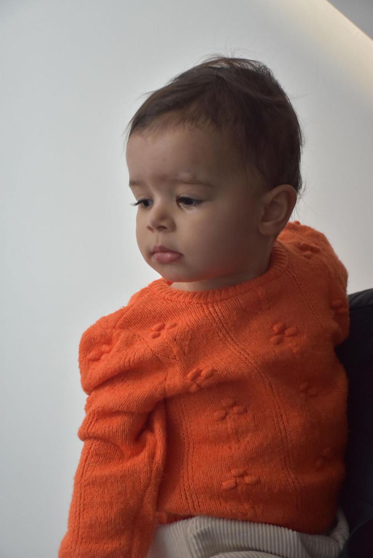 17 aylık Beste bebek, göz kapağı kaldırma ameliyatı ile sağlığına kavuştu