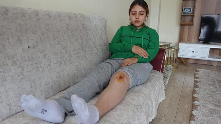 Liseli Özge, köpeklerin saldırısında yaralandı