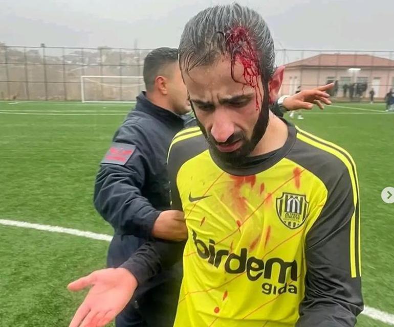 Malatyada amatör maçta kavga çıktı, 1 futbolcu yaralandı