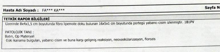 Ameliyatta karnında unutulan makas, 7 yıl sonra baş ağrısıyla ortaya çıktı