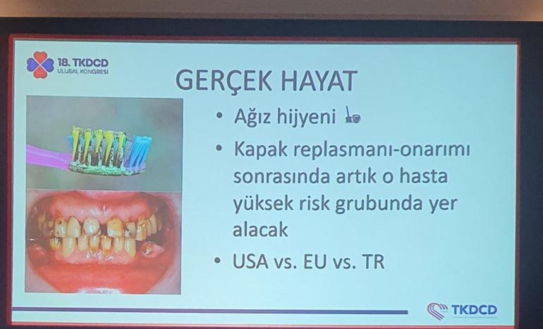 Bilimsel sunumda ortaya çıktı: 6 kişilik ailenin tamamı aynı diş fırçasını kullandı