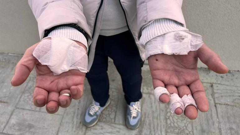 Esenyurtta sokakta beslenen köpekler yoldan geçenlere saldırdı