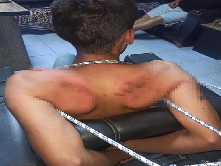 Madem işkence görmedim, sanıkların telefonunda işkence fotoğraflarının ne işi var