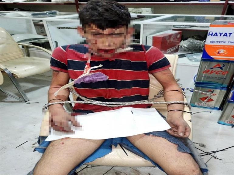 Madem işkence görmedim, sanıkların telefonunda işkence fotoğraflarının ne işi var