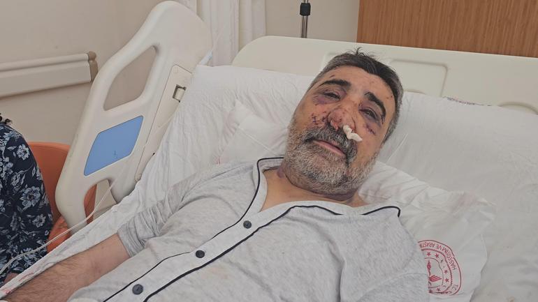 İngiliz boksörün darbettiği taksici konuştu