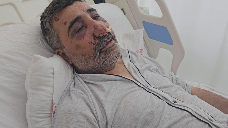 İngiliz boksörün darbettiği taksici konuştu