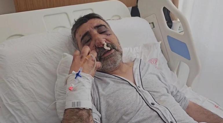 İngiliz boksörün darbettiği taksici konuştu