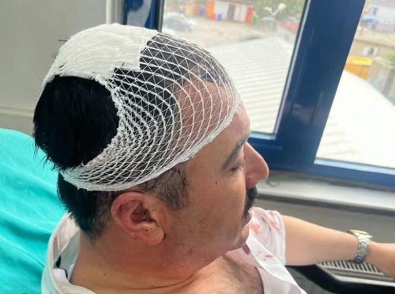 Belediye başkan yardımcısını şekerlikle başından yaralayan il başkan yardımcısı tutuklandı