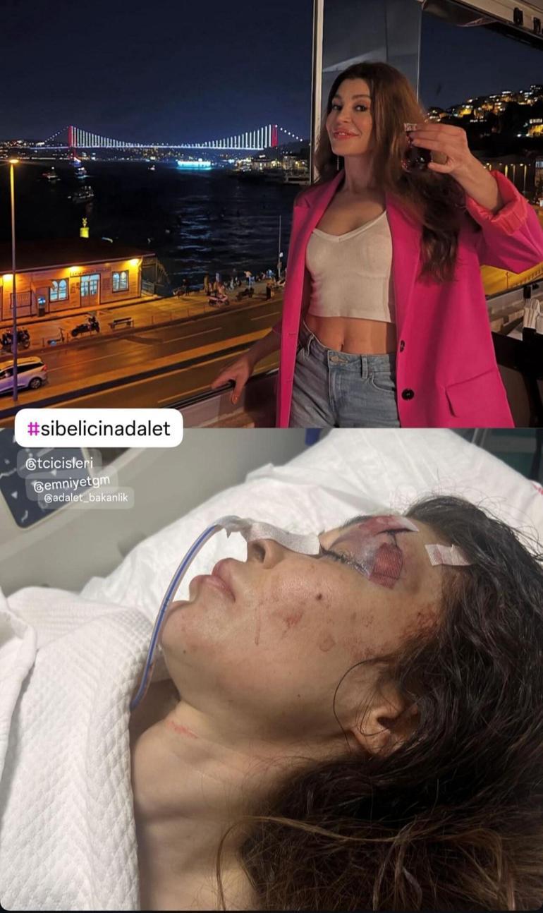 Beşiktaşta şikayet ettiği spor salonu sahibi tarafından bıçaklandı; hastanede yaşam mücadelesi veriyor