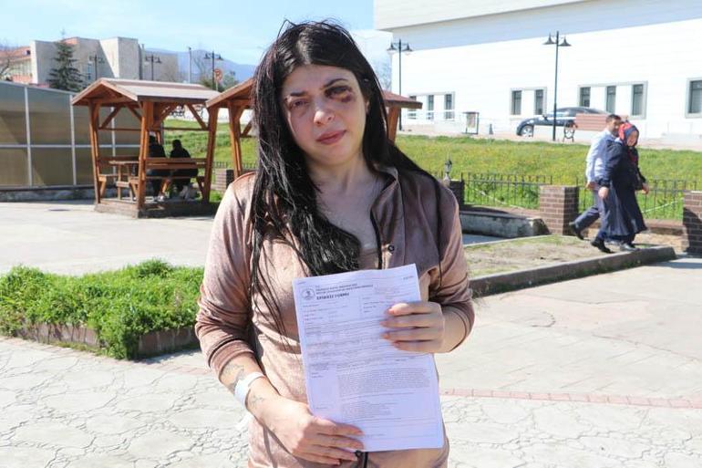 Sokak ortasında darbedilen Damla: Platinler hep yüzümde kalacakmış