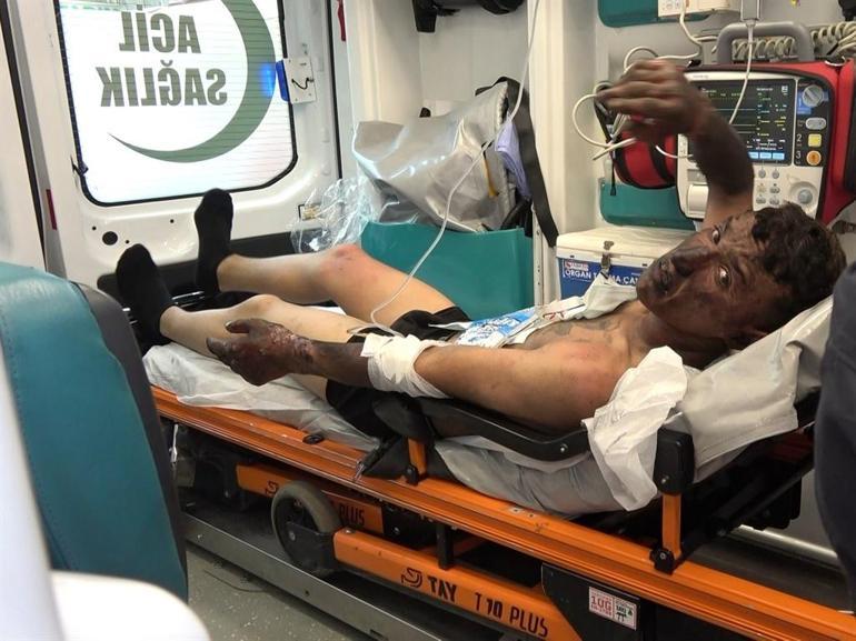 Korku evinde testere tamiri sırasında çıkan yangında 3 kişi yaralandı