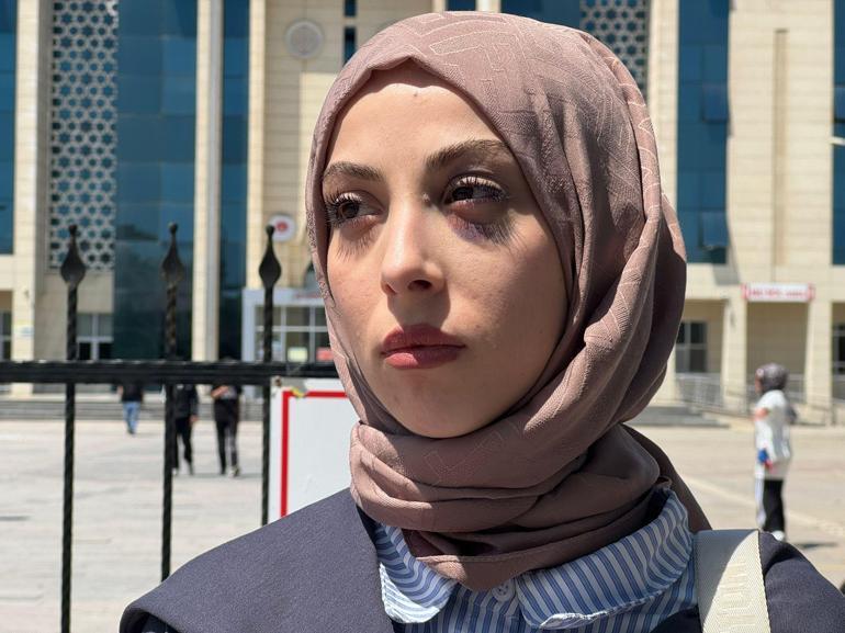 Eski eşi tarafından darbedilen Sena: Kadın cinayeti olarak anılmak istemiyorum