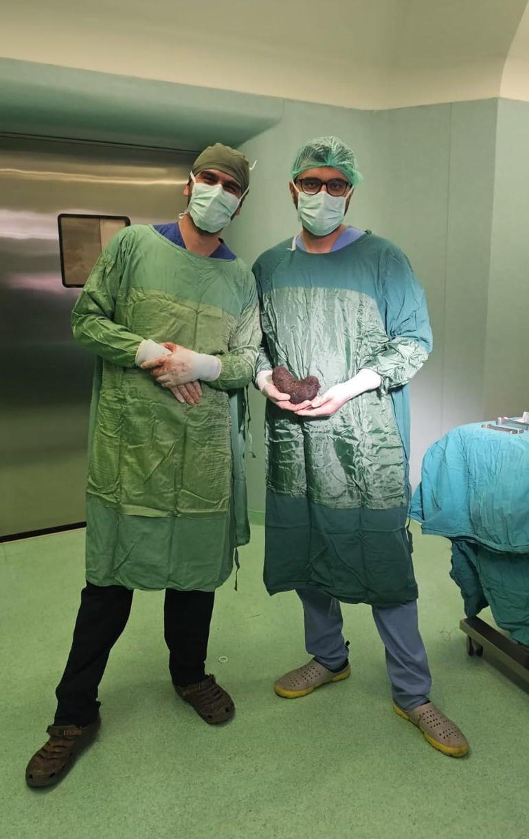 9 yaşındaki çocuğun midesinden saç yumağı çıktı