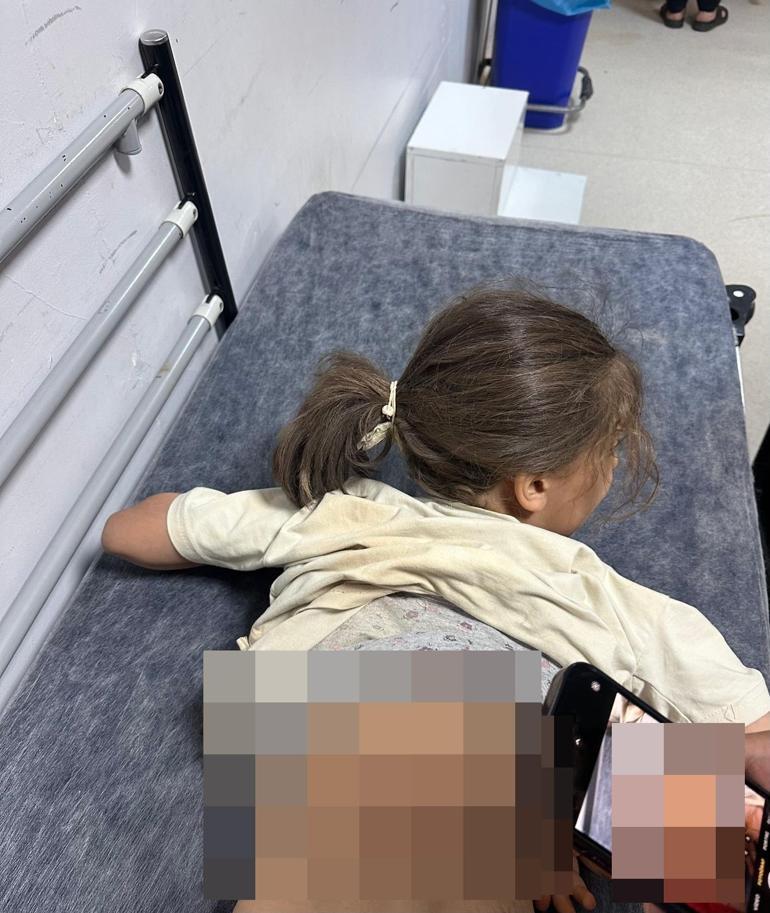 Sokak köpeklerinin saldırısına uğrayan Zeynep, yaralandı