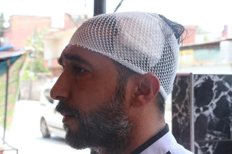 Başına mermi isabet eden döner ustası: Ölebilirdim, suçlu bulunsun