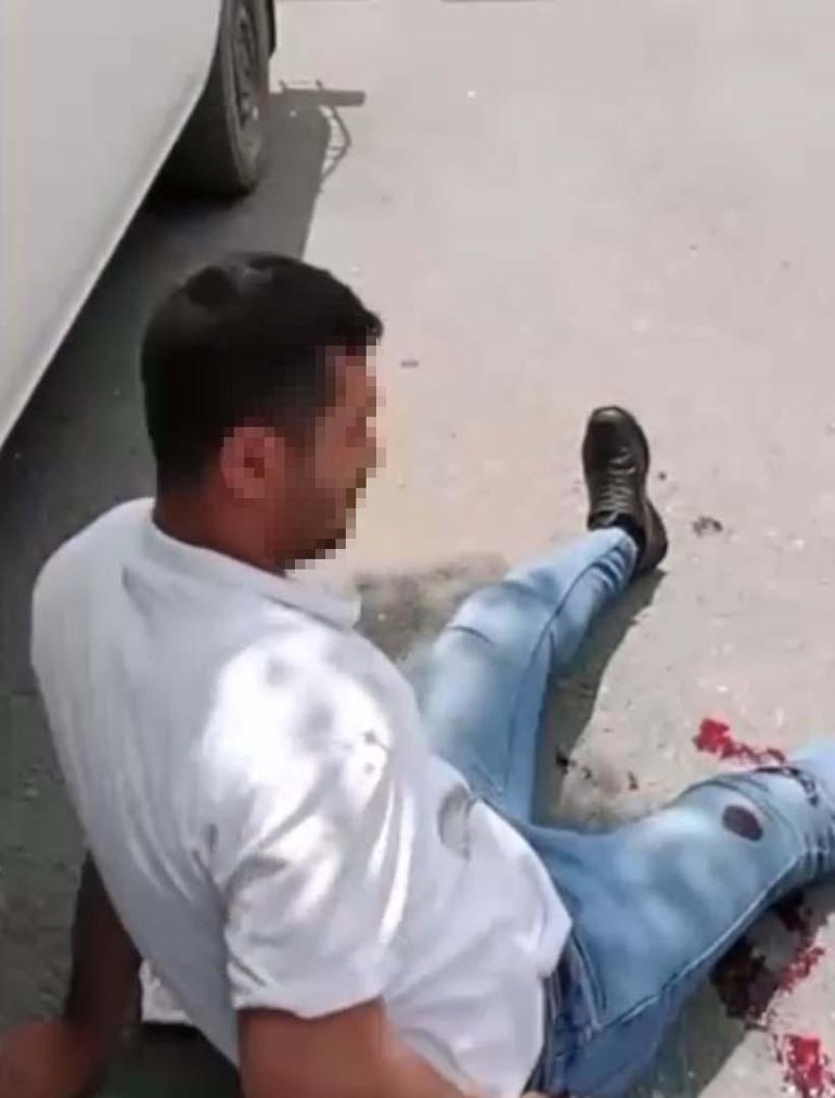 Kendisini rahatsız eden kişiyi bacağından yaralayıp sosyal medyada paylaştı; tutuklandı