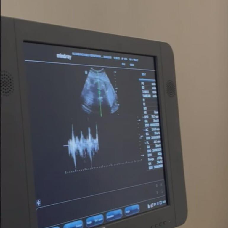 8 aylık bebeği karnında öldü; ihmal iddiasıyla doktordan şikayetçi oldu