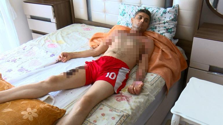 Gaziosmanpaşada telefonunu gasbettiği için kendisinden şikayetçi olan Ahmeti, üzerine benzin dökerek yaktı