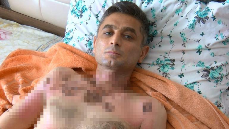 Gaziosmanpaşada telefonunu gasbettiği için kendisinden şikayetçi olan Ahmeti, üzerine benzin dökerek yaktı