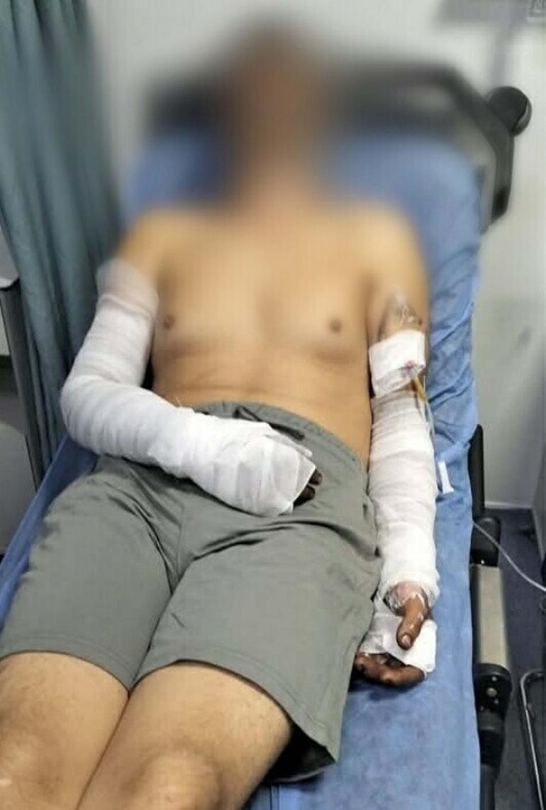 Oto tamirhanesinde patlama; 2 işçi yaralandı